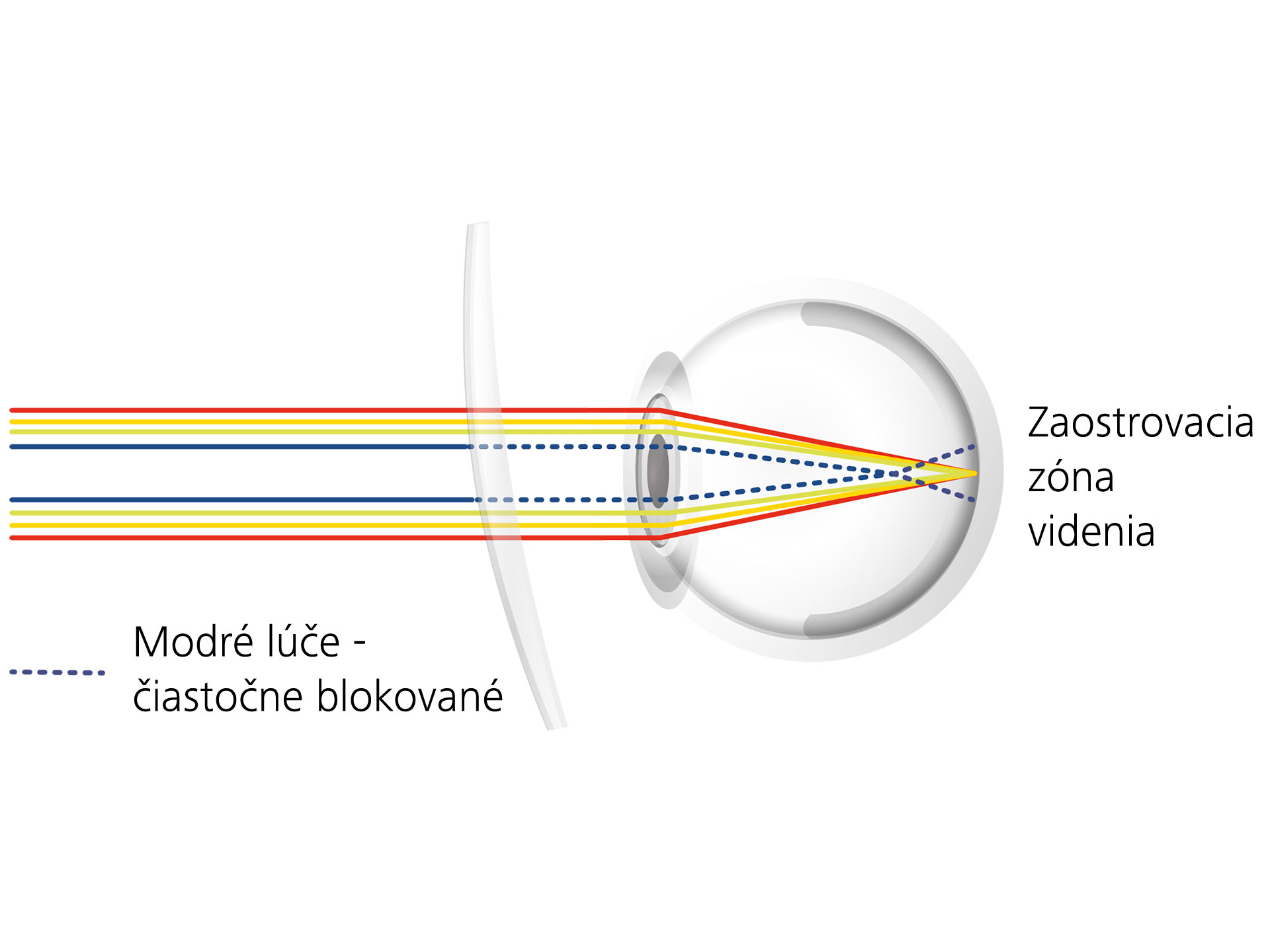 Vizualizácia toho, ako môžu vrstvy šošoviek znížiť oslnenie čiastočným blokovaním modrých lúčov 