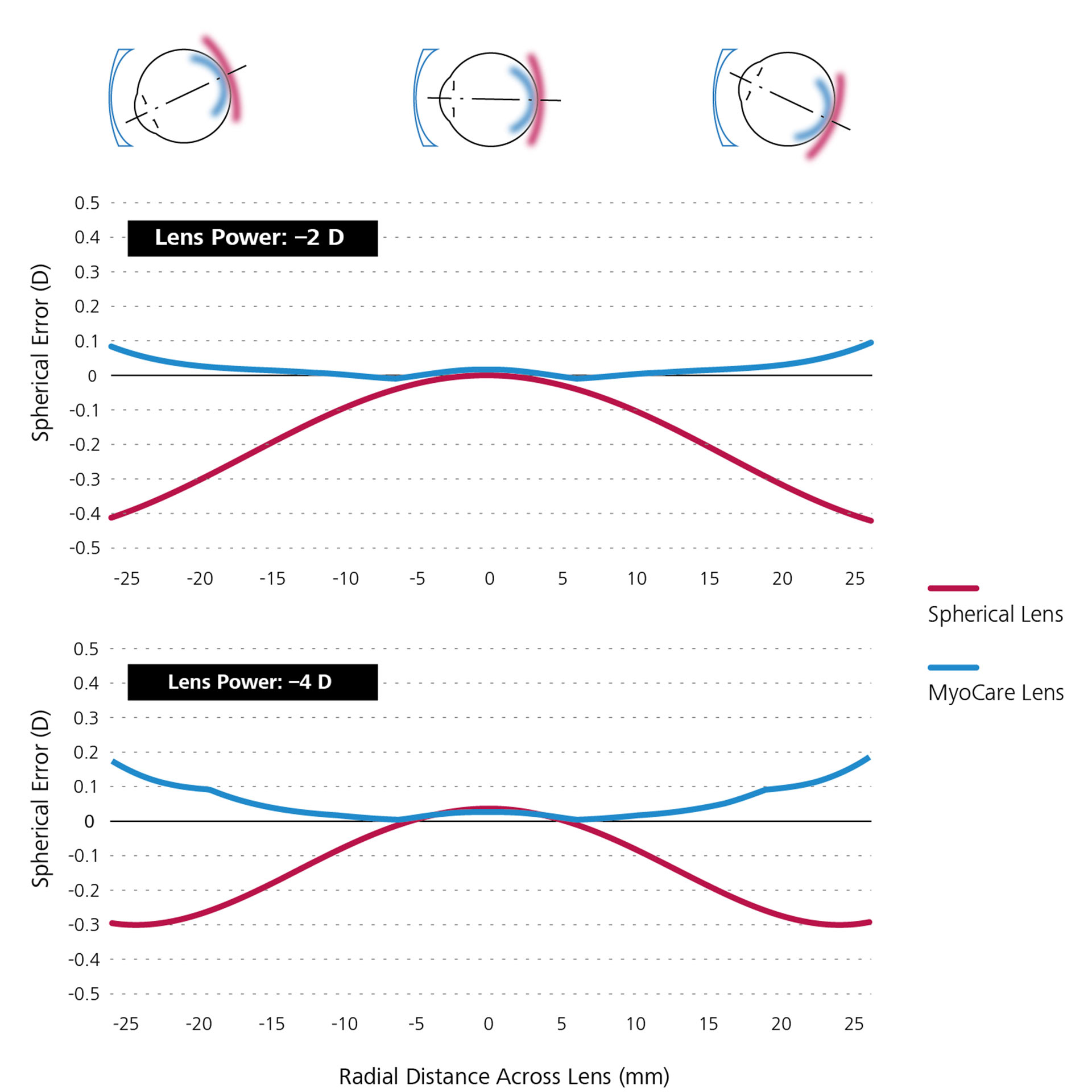 Dva čiarové grafy, ktoré znázorňujú porovnávaciu matematickú simuláciu sférických šošoviek single vision (načerveno) a šošoviek MyoCare (namodro).